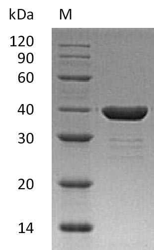(Tris-Glycine gel) Discontinuous SDS-PAGE (reduced) with 5% enrichment gel and 15% separation gel. (Tris-Glycine gel) Discontinuous SDS-PAGE (reduced) with 5% enrichment gel and 15% separation gel.