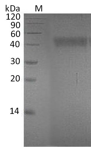 Recombinant Human Ephrin-A4 (EFNA4) , partial (Active) - image 1