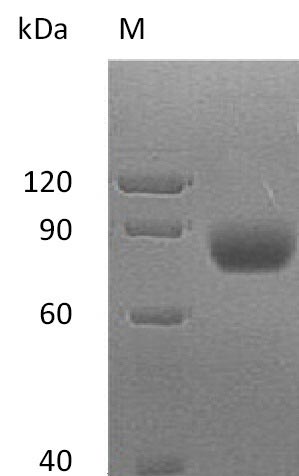 (Tris-Glycine gel) Discontinuous SDS-PAGE (reduced) with 5% enrichment gel and 15% separation gel. (Tris-Glycine gel) Discontinuous SDS-PAGE (reduced) with 5% enrichment gel and 15% separation gel.