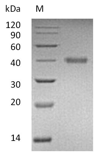 Recombinant Human R-spondin-1 (RSPO1) (Active) - image 1