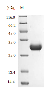 (Tris-Glycine gel) Discontinuous SDS-PAGE (reduced) with 5% enrichment gel and 15% separation gel. (Tris-Glycine gel) Discontinuous SDS-PAGE (reduced) with 5% enrichment gel and 15% separation gel.