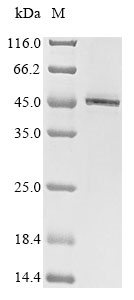 Recombinant Human Arylacetamide deacetylase (AADAC) , partial - image 1