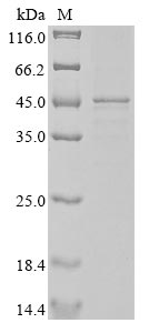 Recombinant Human Actin, cytoplasmic 1 (ACTB) - image 1