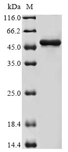 Recombinant Human Actin-related protein 3 (ACTR3) - image 1