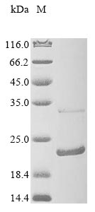 Recombinant Mouse Anterior gradient protein 2 homolog (Agr2) - image 1