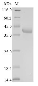 Recombinant Human Fructose-bisphosphate aldolase A (ALDOA) - image 1