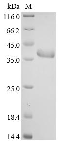 Recombinant Human Fructose-bisphosphate aldolase C (ALDOC) - image 1