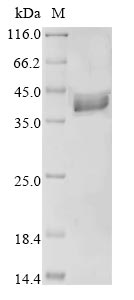 (Tris-Glycine gel) Discontinuous SDS-PAGE (reduced) with 5% enrichment gel and 15% separation gel. (Tris-Glycine gel) Discontinuous SDS-PAGE (reduced) with 5% enrichment gel and 15% separation gel.