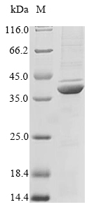(Tris-Glycine gel) Discontinuous SDS-PAGE (reduced) with 5% enrichment gel and 15% separation gel. (Tris-Glycine gel) Discontinuous SDS-PAGE (reduced) with 5% enrichment gel and 15% separation gel.