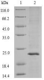 (Tris-Glycine gel) Discontinuous SDS-PAGE (reduced) with 5% enrichment gel and 15% separation gel. (Tris-Glycine gel) Discontinuous SDS-PAGE (reduced) with 5% enrichment gel and 15% separation gel.