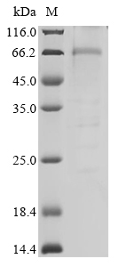(Tris-Glycine gel) Discontinuous SDS-PAGE (reduced) with 5% enrichment gel and 15% separation gel. (Tris-Glycine gel) Discontinuous SDS-PAGE (reduced) with 5% enrichment gel and 15% separation gel.