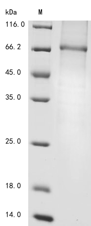 (Tris-Glycine gel) Discontinuous SDS-PAGE (reduced) with 5% enrichment gel and 15% separation gel. (Tris-Glycine gel) Discontinuous SDS-PAGE (reduced) with 5% enrichment gel and 15% separation gel.