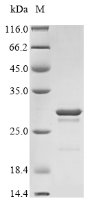 (Tris-Glycine gel) Discontinuous SDS-PAGE (reduced) with 5% enrichment gel and 15% separation gel. (Tris-Glycine gel) Discontinuous SDS-PAGE (reduced) with 5% enrichment gel and 15% separation gel.