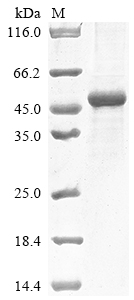 (Tris-Glycine gel) Discontinuous SDS-PAGE (reduced) with 5% enrichment gel and 15% separation gel. (Tris-Glycine gel) Discontinuous SDS-PAGE (reduced) with 5% enrichment gel and 15% separation gel.