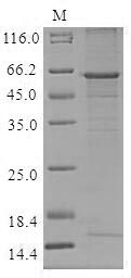 (Tris-Glycine gel) Discontinuous SDS-PAGE (reduced) with 5% enrichment gel and 15% separation gel. (Tris-Glycine gel) Discontinuous SDS-PAGE (reduced) with 5% enrichment gel and 15% separation gel.
