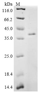 Recombinant Mouse CCN family member 1 (Ccn1) - image 1