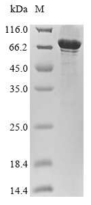 Recombinant Human ATP-dependent RNA helicase DDX3X (DDX3X) - image 1