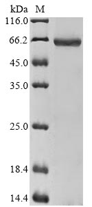 (Tris-Glycine gel) Discontinuous SDS-PAGE (reduced) with 5% enrichment gel and 15% separation gel. (Tris-Glycine gel) Discontinuous SDS-PAGE (reduced) with 5% enrichment gel and 15% separation gel.