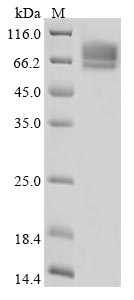 (Tris-Glycine gel) Discontinuous SDS-PAGE (reduced) with 5% enrichment gel and 15% separation gel. (Tris-Glycine gel) Discontinuous SDS-PAGE (reduced) with 5% enrichment gel and 15% separation gel.