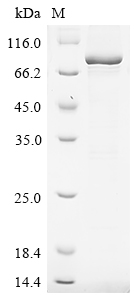 (Tris-Glycine gel) Discontinuous SDS-PAGE (reduced) with 5% enrichment gel and 15% separation gel. (Tris-Glycine gel) Discontinuous SDS-PAGE (reduced) with 5% enrichment gel and 15% separation gel.