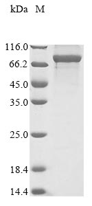 Recombinant Human Cytoplasmic dynein 1 intermediate chain 1 (DYNC1I1) - image 1
