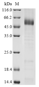 (Tris-Glycine gel) Discontinuous SDS-PAGE (reduced) with 5% enrichment gel and 15% separation gel. (Tris-Glycine gel) Discontinuous SDS-PAGE (reduced) with 5% enrichment gel and 15% separation gel.