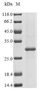 (Tris-Glycine gel) Discontinuous SDS-PAGE (reduced) with 5% enrichment gel and 15% separation gel. (Tris-Glycine gel) Discontinuous SDS-PAGE (reduced) with 5% enrichment gel and 15% separation gel.