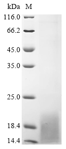(Tris-Glycine gel) Discontinuous SDS-PAGE (reduced) with 5% enrichment gel and 15% separation gel. (Tris-Glycine gel) Discontinuous SDS-PAGE (reduced) with 5% enrichment gel and 15% separation gel.