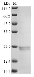 (Tris-Glycine gel) Discontinuous SDS-PAGE (reduced) with 5% enrichment gel and 15% separation gel. (Tris-Glycine gel) Discontinuous SDS-PAGE (reduced) with 5% enrichment gel and 15% separation gel.