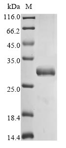 (Tris-Glycine gel) Discontinuous SDS-PAGE (reduced) with 5% enrichment gel and 15% separation gel. (Tris-Glycine gel) Discontinuous SDS-PAGE (reduced) with 5% enrichment gel and 15% separation gel.