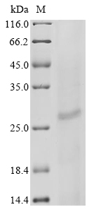 (Tris-Glycine gel) Discontinuous SDS-PAGE (reduced) with 5% enrichment gel and 15% separation gel. (Tris-Glycine gel) Discontinuous SDS-PAGE (reduced) with 5% enrichment gel and 15% separation gel.