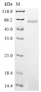 Recombinant Human Formimidoyltransferase-cyclodeaminase (FTCD) - image 1