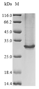 (Tris-Glycine gel) Discontinuous SDS-PAGE (reduced) with 5% enrichment gel and 15% separation gel. (Tris-Glycine gel) Discontinuous SDS-PAGE (reduced) with 5% enrichment gel and 15% separation gel.
