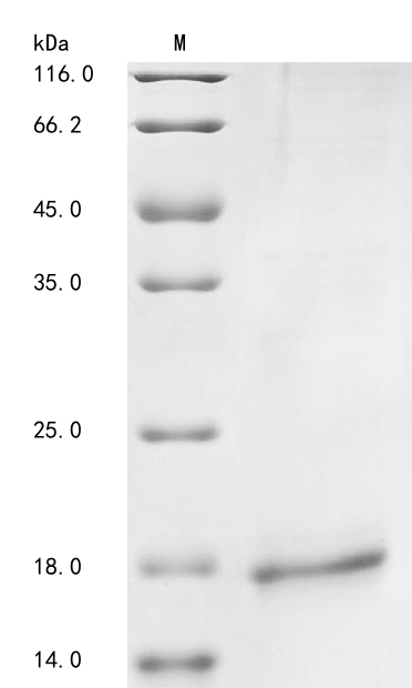 (Tris-Glycine gel) Discontinuous SDS-PAGE (reduced) with 5% enrichment gel and 15% separation gel. (Tris-Glycine gel) Discontinuous SDS-PAGE (reduced) with 5% enrichment gel and 15% separation gel.