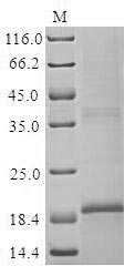 (Tris-Glycine gel) Discontinuous SDS-PAGE (reduced) with 5% enrichment gel and 15% separation gel. (Tris-Glycine gel) Discontinuous SDS-PAGE (reduced) with 5% enrichment gel and 15% separation gel.