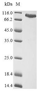 (Tris-Glycine gel) Discontinuous SDS-PAGE (reduced) with 5% enrichment gel and 15% separation gel. (Tris-Glycine gel) Discontinuous SDS-PAGE (reduced) with 5% enrichment gel and 15% separation gel.
