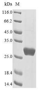 (Tris-Glycine gel) Discontinuous SDS-PAGE (reduced) with 5% enrichment gel and 15% separation gel. (Tris-Glycine gel) Discontinuous SDS-PAGE (reduced) with 5% enrichment gel and 15% separation gel.