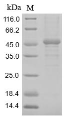 (Tris-Glycine gel) Discontinuous SDS-PAGE (reduced) with 5% enrichment gel and 15% separation gel. (Tris-Glycine gel) Discontinuous SDS-PAGE (reduced) with 5% enrichment gel and 15% separation gel.