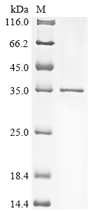 Recombinant Human Hyaluronan and proteoglycan link protein 2 (HAPLN2) - image 1