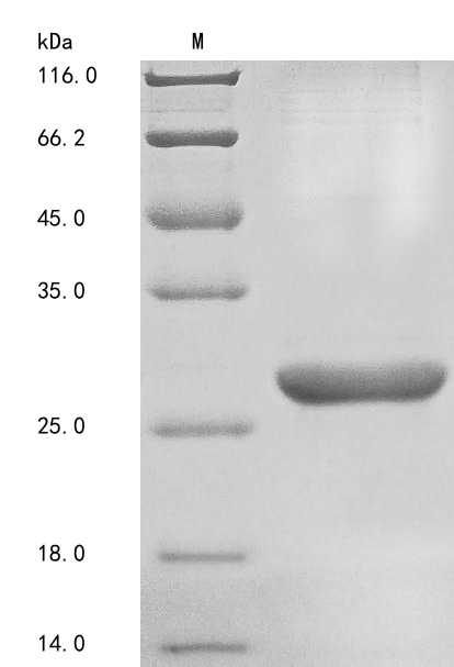 Recombinant Human Basement membrane-specific heparan sulfate proteoglycan core protein (HSPG2) , partial - image 1