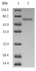 (Tris-Glycine gel) Discontinuous SDS-PAGE (reduced) with 5% enrichment gel and 15% separation gel. (Tris-Glycine gel) Discontinuous SDS-PAGE (reduced) with 5% enrichment gel and 15% separation gel.