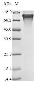 (Tris-Glycine gel) Discontinuous SDS-PAGE (reduced) with 5% enrichment gel and 15% separation gel. (Tris-Glycine gel) Discontinuous SDS-PAGE (reduced) with 5% enrichment gel and 15% separation gel.