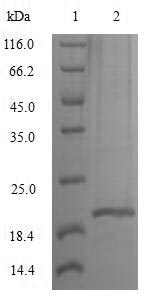 (Tris-Glycine gel) Discontinuous SDS-PAGE (reduced) with 5% enrichment gel and 15% separation gel. (Tris-Glycine gel) Discontinuous SDS-PAGE (reduced) with 5% enrichment gel and 15% separation gel.