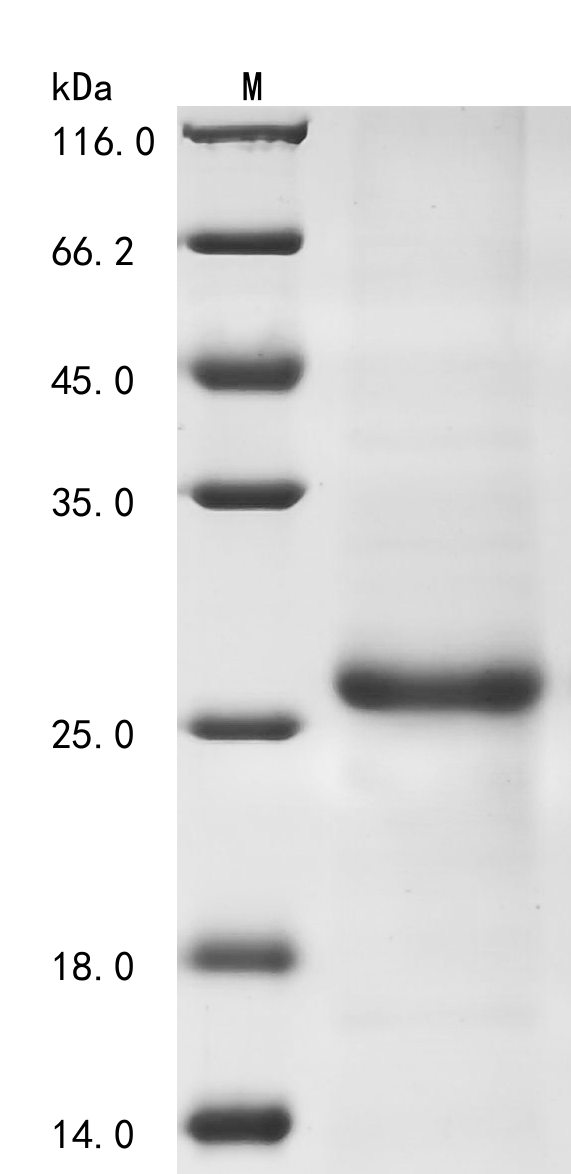 (Tris-Glycine gel) Discontinuous SDS-PAGE (reduced) with 5% enrichment gel and 15% separation gel. (Tris-Glycine gel) Discontinuous SDS-PAGE (reduced) with 5% enrichment gel and 15% separation gel.