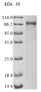 Recombinant Mouse Interleukin-1 receptor-associated kinase 3 (Irak3) - image 1