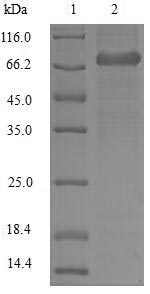 (Tris-Glycine gel) Discontinuous SDS-PAGE (reduced) with 5% enrichment gel and 15% separation gel. (Tris-Glycine gel) Discontinuous SDS-PAGE (reduced) with 5% enrichment gel and 15% separation gel.
