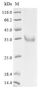 Recombinant Human L-lactate dehydrogenase C chain (LDHC) - image 1