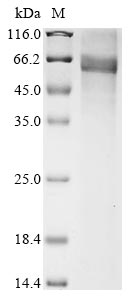 (Tris-Glycine gel) Discontinuous SDS-PAGE (reduced) with 5% enrichment gel and 15% separation gel. (Tris-Glycine gel) Discontinuous SDS-PAGE (reduced) with 5% enrichment gel and 15% separation gel.