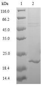 (Tris-Glycine gel) Discontinuous SDS-PAGE (reduced) with 5% enrichment gel and 15% separation gel. (Tris-Glycine gel) Discontinuous SDS-PAGE (reduced) with 5% enrichment gel and 15% separation gel.