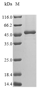 Recombinant Human Melanoma-associated antigen B2 (MAGEB2) - image 1